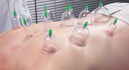 http---o.aolcdn.com-hss-storage-midas-8833f82d0bc6b8004d6e36bf63f8916f-204184101-stock-photo-acupuncture-fire-cupping-detail-on-man-s-back-285433880